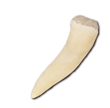 エンコダスの歯